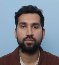 Saransh Choudhary after hair transplant