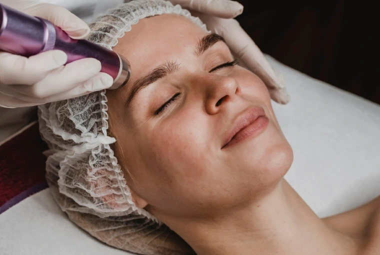 MNRF Treatment in Delhi