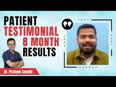 Patient testimonial | Hair Transplant Results After 8 Months | Best Hair Transplant in Delhi
