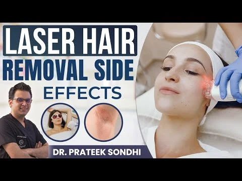 Laser Hair Removal के Side Effects Permanent Hair Removal Dr. Prateek Sondhi, Derma Circles Delhi